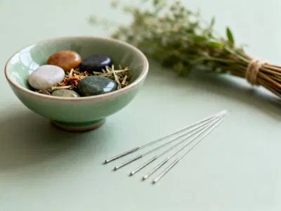Established Acupuncture Practice with Strong Patient Loyalty